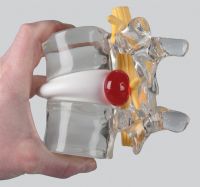 hernie disciale pedicurie ruffec