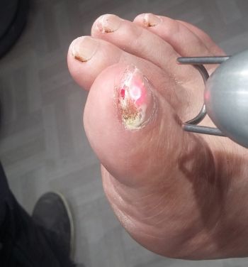 pédicurie podologie ruffec