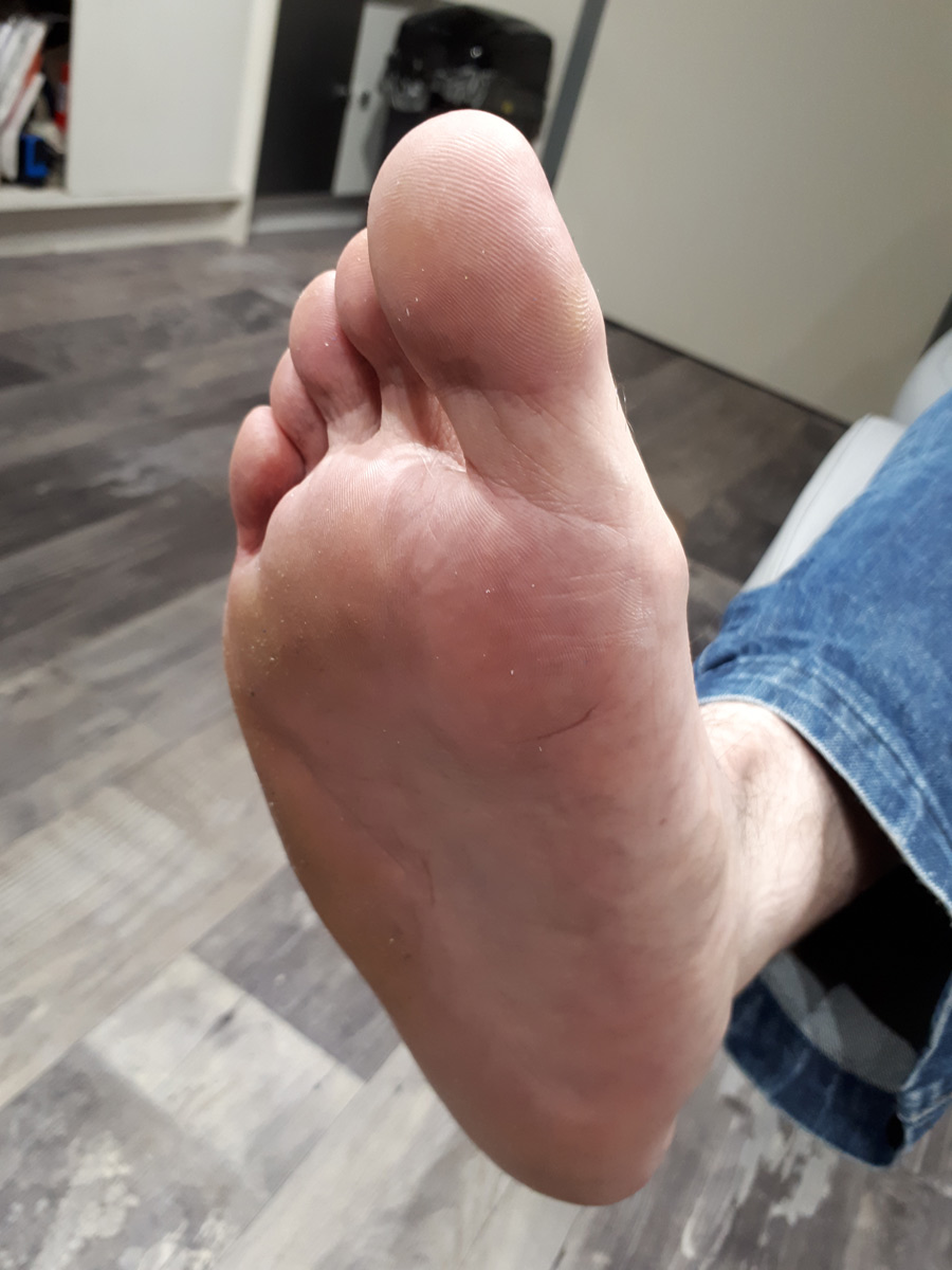 pied plat podologie ruffec