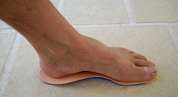 semelle orthopédique ruffec